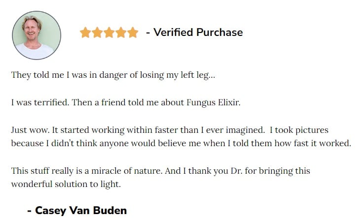 lungs,nail fungus,lion's mane review,lions mane mushroom review,birch tree fungus,lion's mane mushroom review,remedies for the lungs,remedies for toe fungus,how to correct toe fungus,remedies for toe nail fungus,how to correct toe nail fungus,fungus on toes,elixir neogadine kaise use kare,toenail fungus,toe nail fungus,manuka honey for acne review,cordyceps fungus,neogadine elixir,caterpillar fungus,pain relief,elixir neogadine dosage